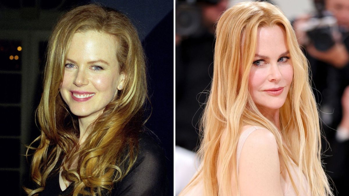 Has Nicole Kidman Gotten Plastic Surgery