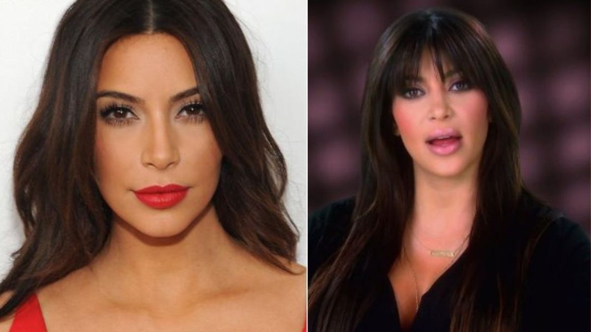 How Did Kim Kardashian Appear After Plastic Surgery