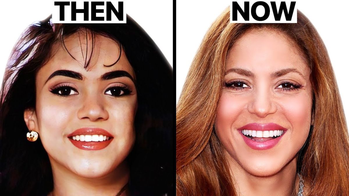 Has Shakira Undergone Plastic Surgery
